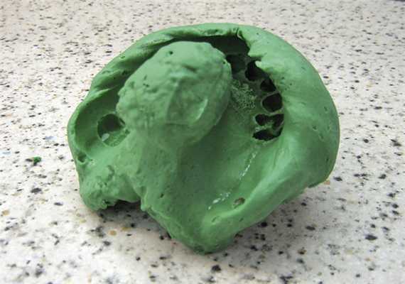 Рис. 5. Альгинатный оттиск верхней челюсти.