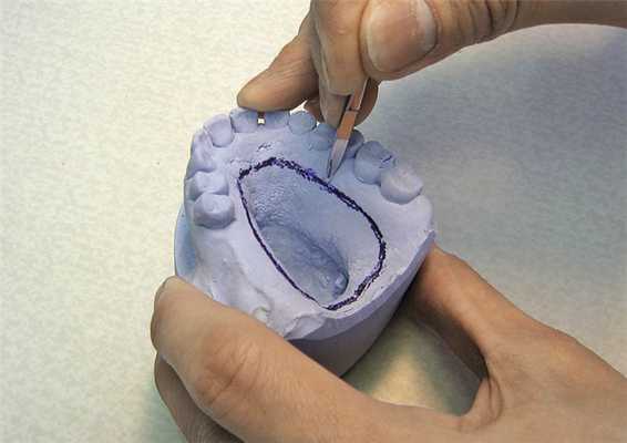 Рис. 6. Гравировка замыкающего валика.