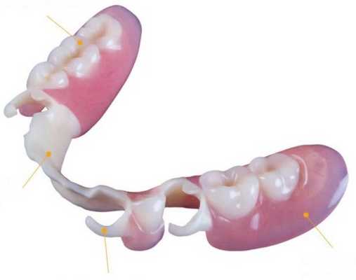Пластиночный протез фото 3