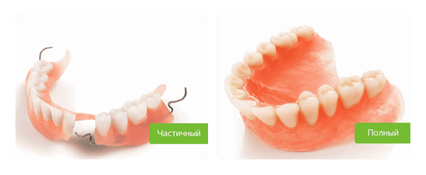полный и частичный пластинчатый протез