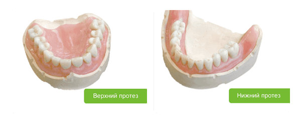 протезирование акри фри на верхнюю и нижнюю челюсть