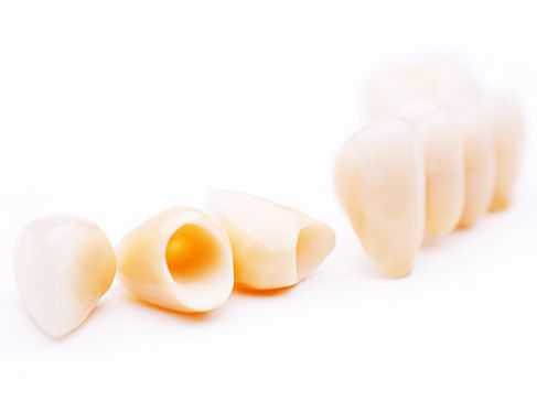 Провизорные коронки