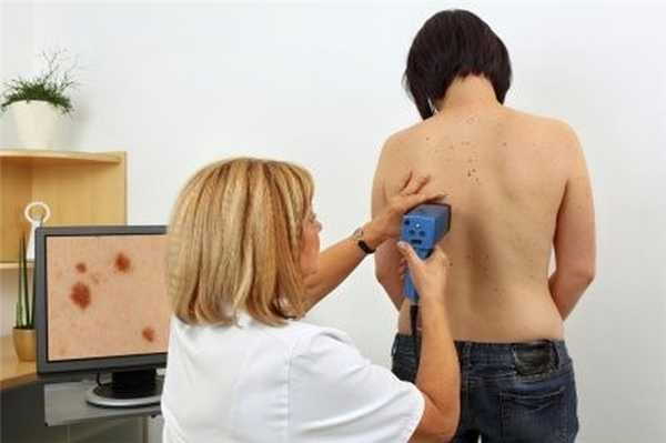 компьютерная дерматоскопия родинок