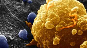 Бесплатная консультация оперирующего онколога