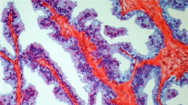Скидка на обследование перед операцией