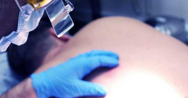 Предраковые новообразования (преканкрозы)