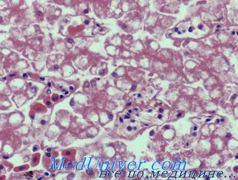 почки при интоксикации йодом