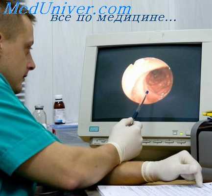 полипоз кишечника