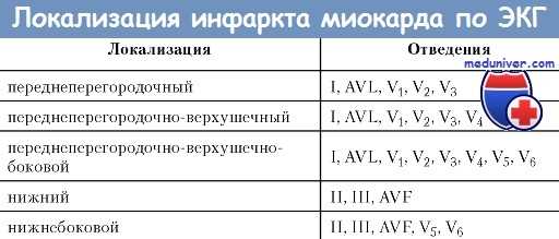 Локализация инфаркта миокарда по ЭКГ