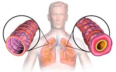 Масляная эмболия