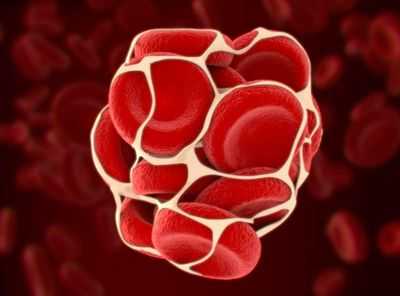 Тканевая эмболия