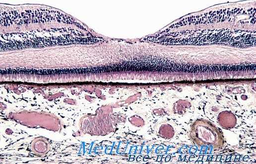 сетчатка при отравлении йодом