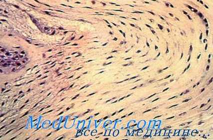 орган зрения при отравлении йодом