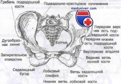 перелом костей таза
