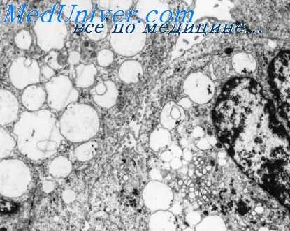 воспалительная реакция