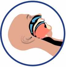 нормальное дыхание без храпа с капой Dental Sleep