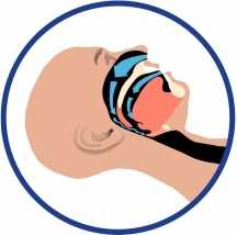 храп и остановки дыхания во сне апноэ