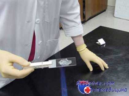 мазок на флору