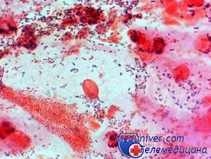 мазок на флору