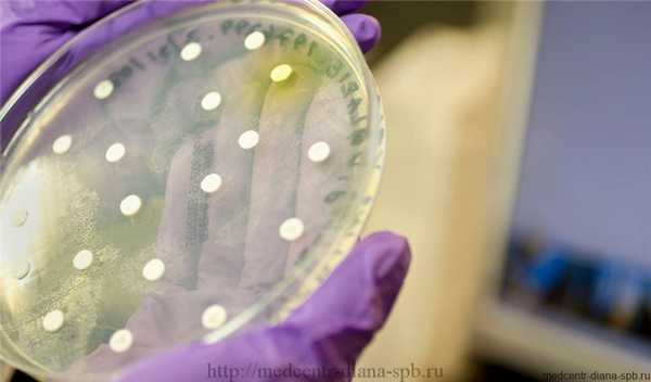 Главный женский анализ — мазок на флору: просто о сложном