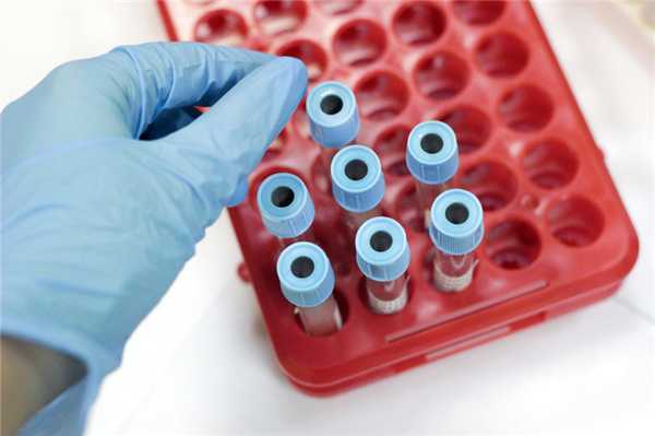 алгоритм взятия венозной крови