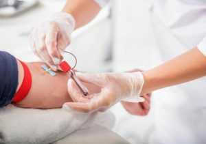 как правильно сдавать кровь из вены