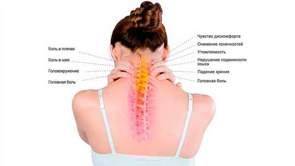 Симптомы шейного остеохондроза