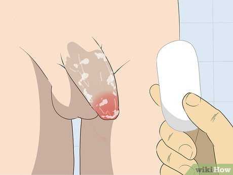 Изображение с названием Free a Penis from a Stuck Zipper Step 5