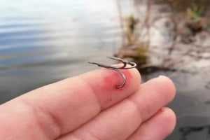 как извлечь рыболовный крючок из пальца