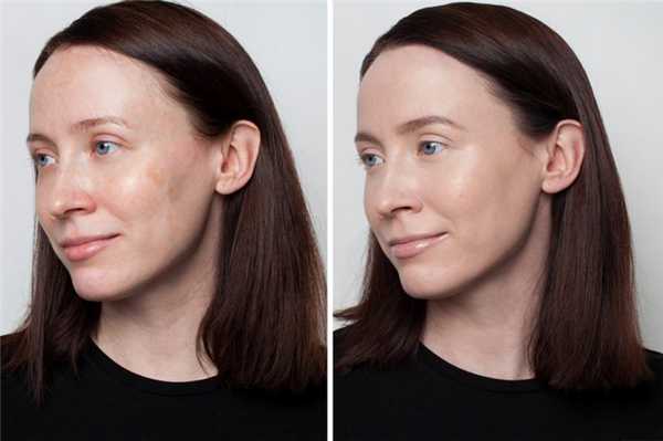 Как скрыть пигментное пятно? Лучшие советы визажистов