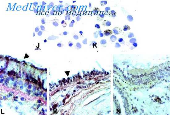 воспаление при бронхиальной астме