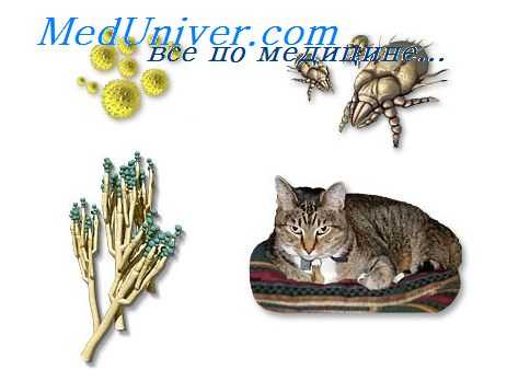 астма бронхиальная