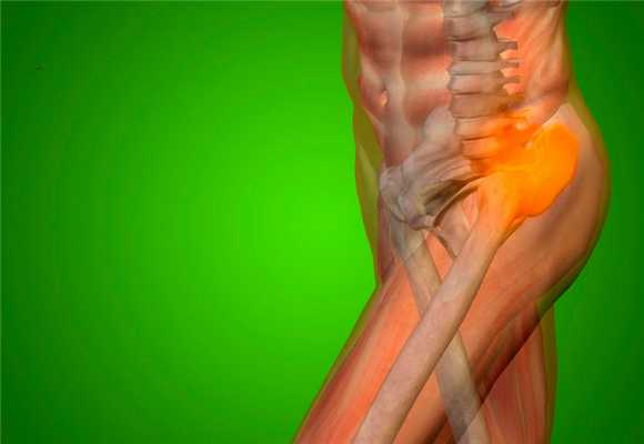 Боль в тазобедренном суставе