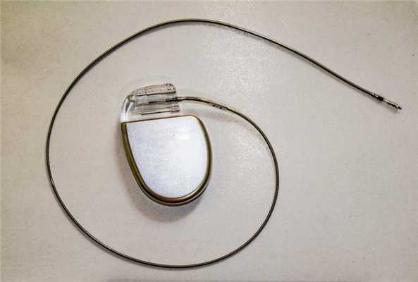 Имплантируемые дефибрилляторы-кардиовертеры при тахикардии