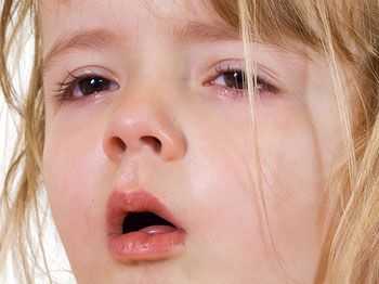 Кашель у ребёнка