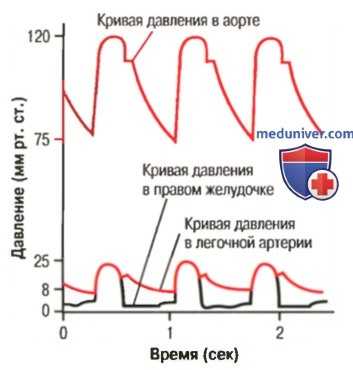 Легочное кровообращение. Анатомия легочного кровообращения