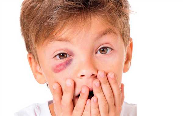 Травмы в детском возрасте