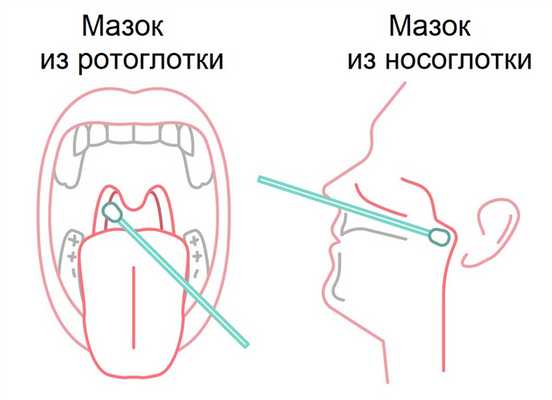 тест на коронавирус.jpg