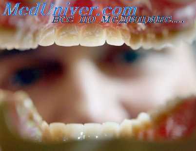 кламмерный протез