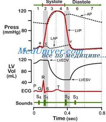 стеноз клапана легочной артерии