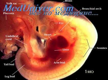 ахондрогенез у плода