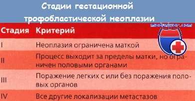 Стадии гестационной трофобластической неоплазии (ГТН)