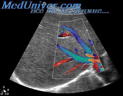 исследование железы