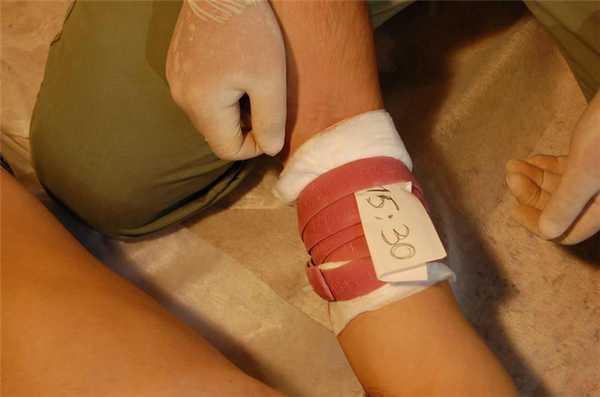 Жгут для остановки крови