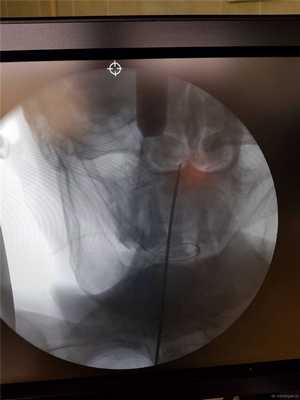 прямая проекция