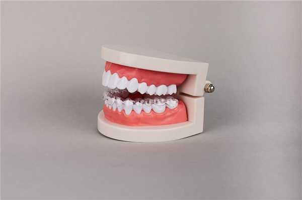 классификация кариеса по Блэку