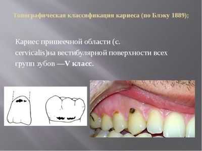 5 класс по Блэку