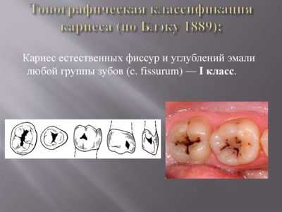 1 класс по Блэку