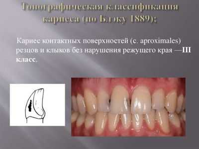 3 класс по Блэку