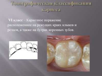 6 класс по Блэку